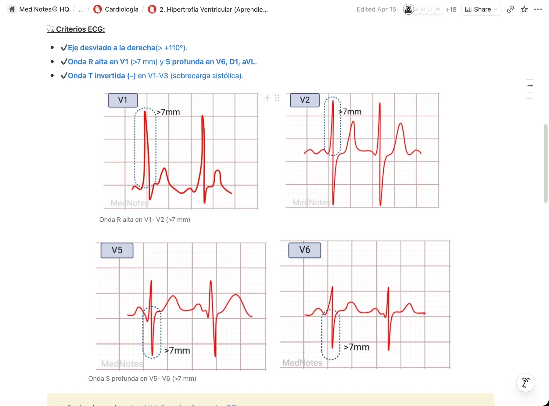 Cardiología · Electrocardiograma patológico paso a paso