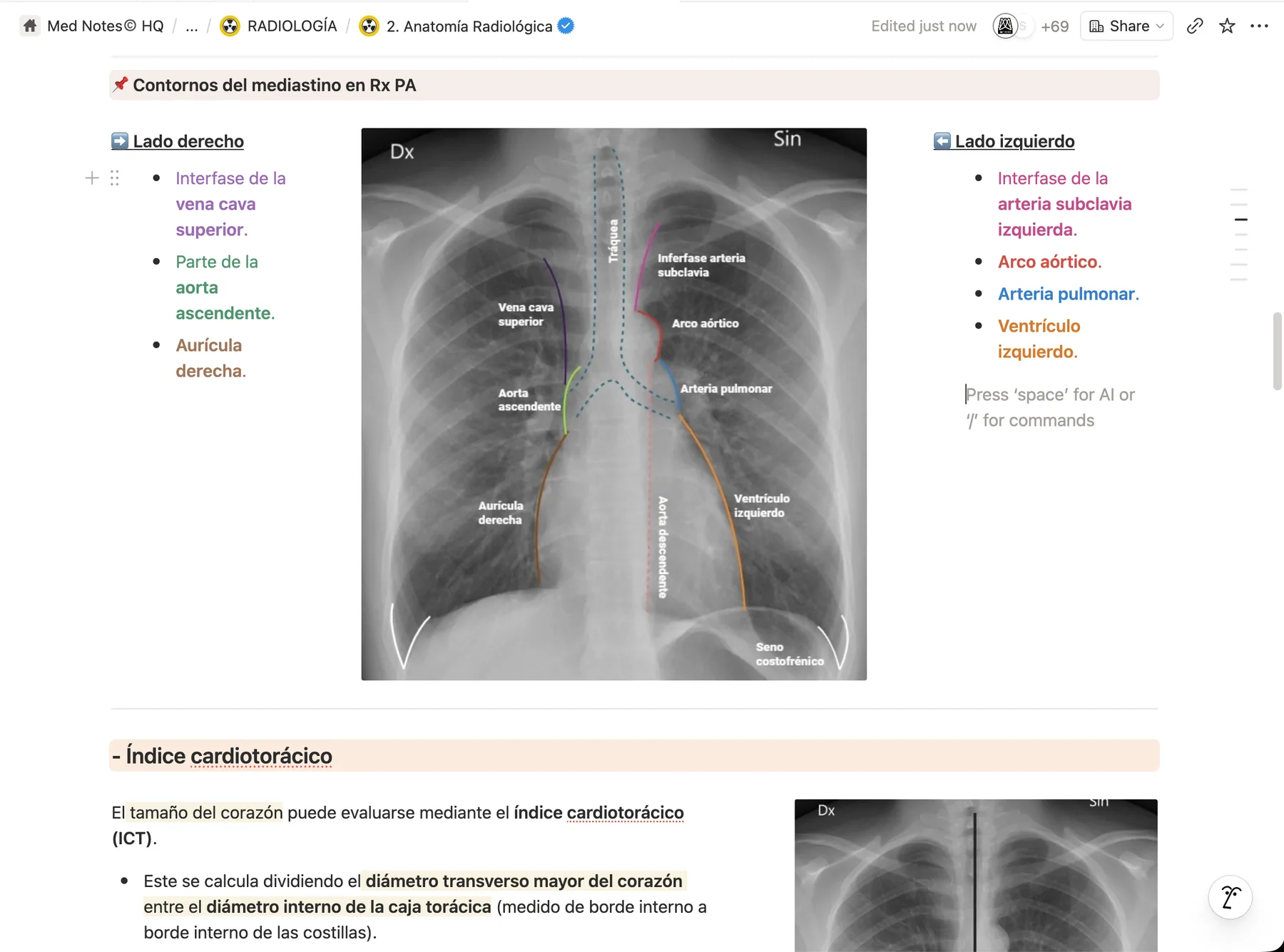 Radiología · RX de Tórax paso a paso