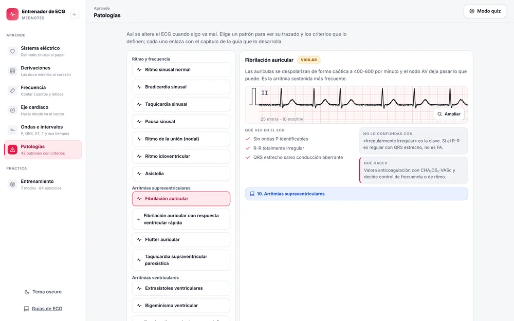 Entrenador de ECG: catálogo de patologías con su trazado y criterios