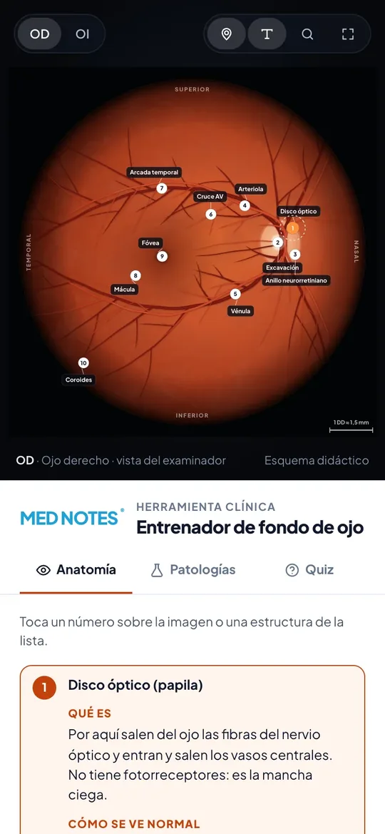 Entrenador de fondo de ojo en el celular: la retina con sus estructuras marcadas
